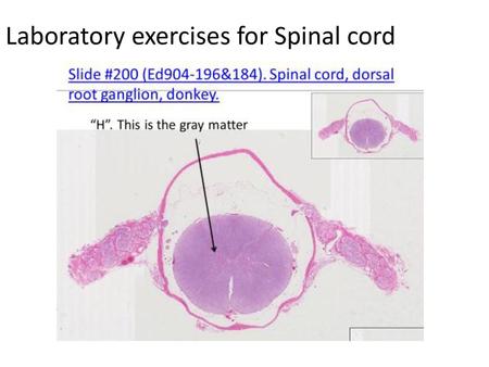 Laboratory exercises for Spinal cord