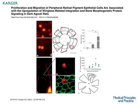 Proliferation and Migration of Peripheral Retinal Pigment Epithelial Cells Are Associated with the Upregulation of Wingless-Related Integration and Bone.