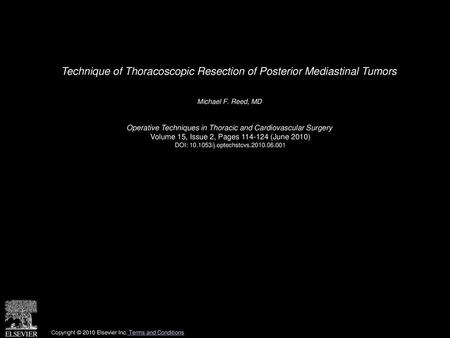 Technique of Thoracoscopic Resection of Posterior Mediastinal Tumors