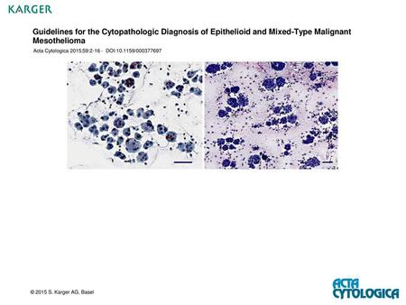 Acta Cytologica 2015;59: DOI: /