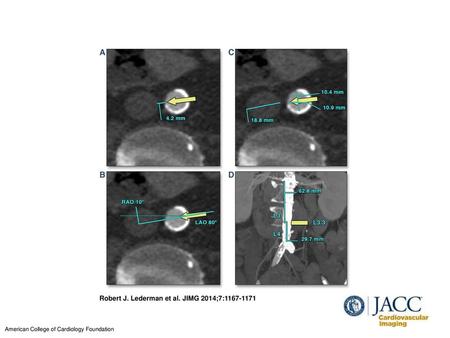 Robert J. Lederman et al. JIMG 2014;7: