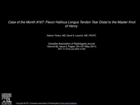 Nathan Thakur, MD, David A. Leswick, MD, FRCPC 