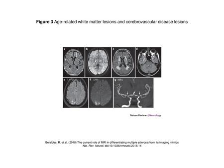 Nat. Rev. Neurol. doi: /nrneurol