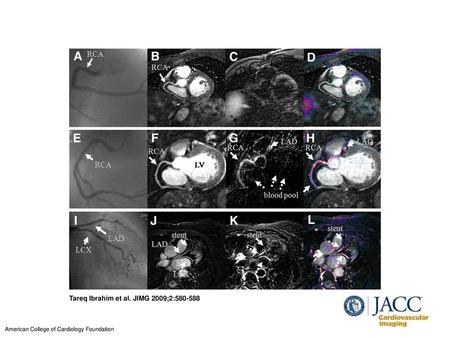 Tareq Ibrahim et al. JIMG 2009;2: