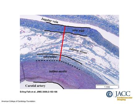 Erling Falk et al. JIMG 2009;2: