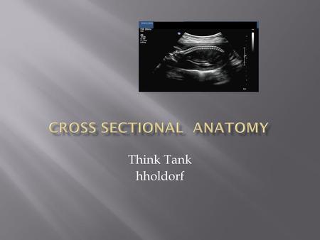 Cross Sectional Anatomy