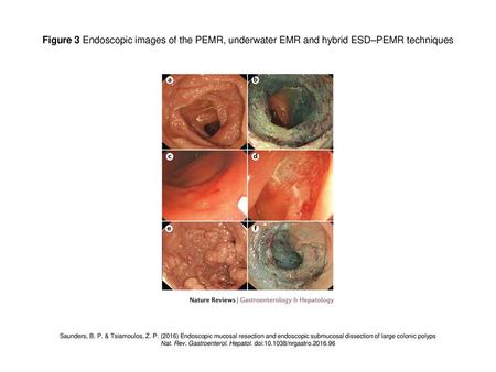 Nat. Rev. Gastroenterol. Hepatol. doi: /nrgastro