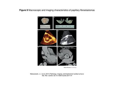 Nat. Rev. Cardiol. doi: /nrcardio