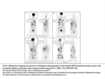 Figure 1. Patterns of HER2–PET/CT confronted with FDG–PET/CT, Maximum intensity projection. Lesion uptake was considered pertinent when visually higher.