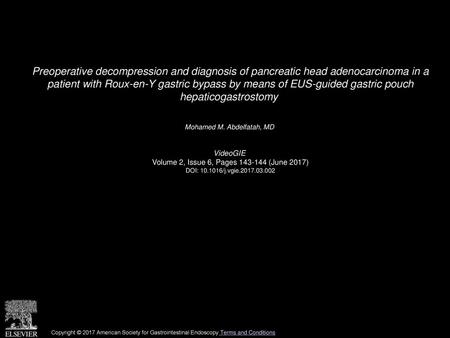 Preoperative decompression and diagnosis of pancreatic head adenocarcinoma in a patient with Roux-en-Y gastric bypass by means of EUS-guided gastric pouch.