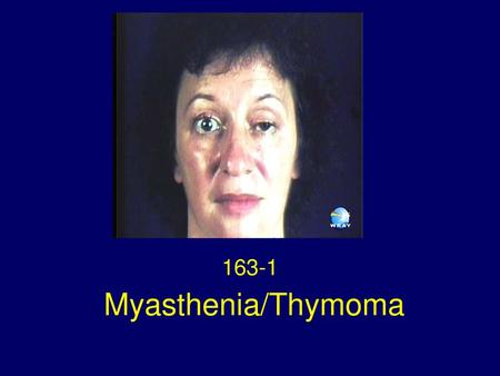 163-1 Myasthenia/Thymoma.