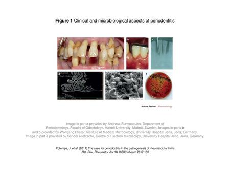 Figure 1 Clinical and microbiological aspects of periodontitis