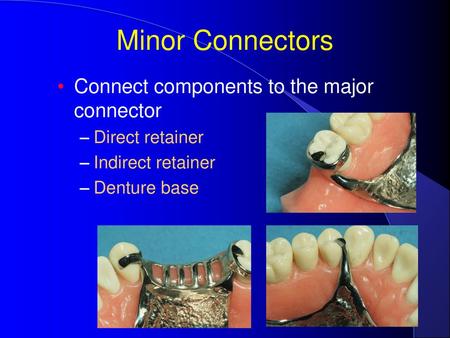 Minor Connectors Connect components to the major connector