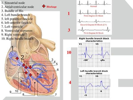 1. Sinoatrial node 2. Atrialventricular node 3. Bundle of His