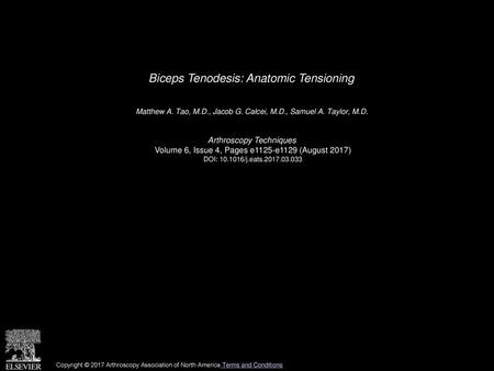 Biceps Tenodesis: Anatomic Tensioning