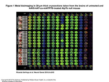 Figure 1 Metal bioimaging in 30-μm thick cryosections taken from the brains of untreated and AAV8-AAT-co-miATP7B-treated Atp7b null mouse Metal bioimaging.