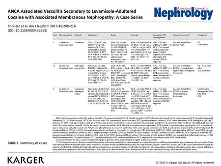 ANCA Associated Vasculitis Secondary to Levamisole-Adultered Cocaine with Associated Membranous Nephropathy: A Case Series Collister et al. Am J Nephrol.