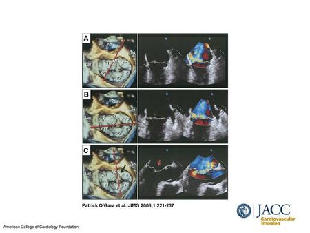 Patrick O’Gara et al. JIMG 2008;1: