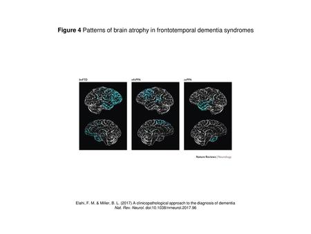 Nat. Rev. Neurol. doi: /nrneurol