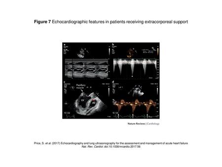 Nat. Rev. Cardiol. doi: /nrcardio