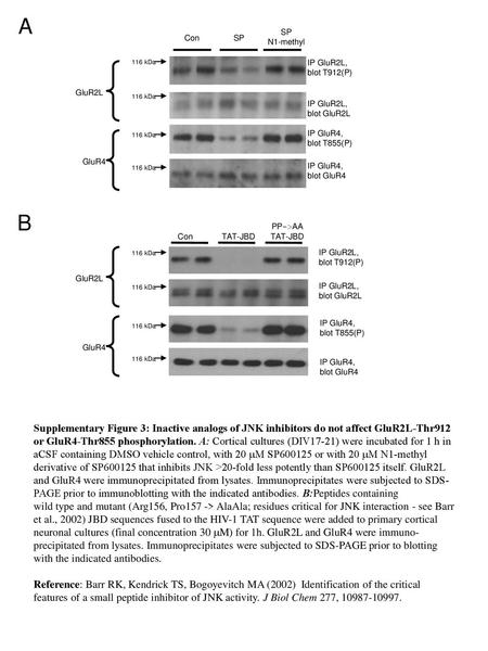 A SP N1-methyl Con SP 116 kDa IP GluR2L, blot T912(P) GluR2L 116 kDa