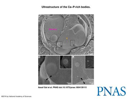 Ultrastructure of the Ca–P-rich bodies.