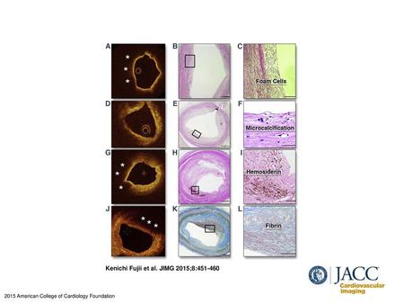 Kenichi Fujii et al. JIMG 2015;8: