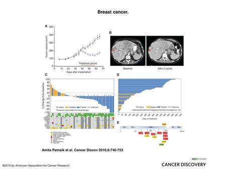 Breast cancer. Breast cancer. A, antitumor activity of abemaciclib in a human xenograft model (T47D) of ER-positive, HER2-negative breast cancer. Athymic.