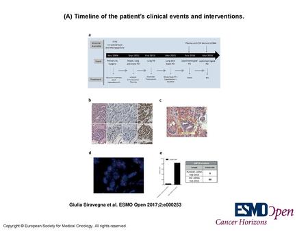 (A) Timeline of the patient’s clinical events and interventions.