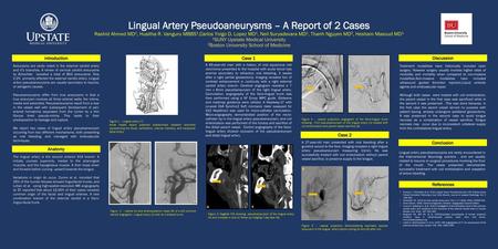 Lingual Artery Pseudoaneurysms – A Report of 2 Cases Rashid Ahmed MD1, Husitha R. Vanguru MBBS1,Carlos Ynigo D. Lopez MD1, Neil Suryadevara MD1, Thanh.