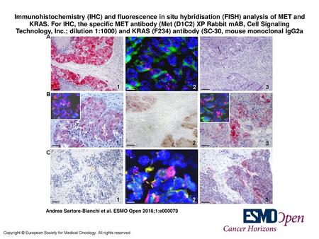 Immunohistochemistry (IHC) and fluorescence in situ hybridisation (FISH) analysis of MET and KRAS. For IHC, the specific MET antibody (Met (D1C2) XP Rabbit.