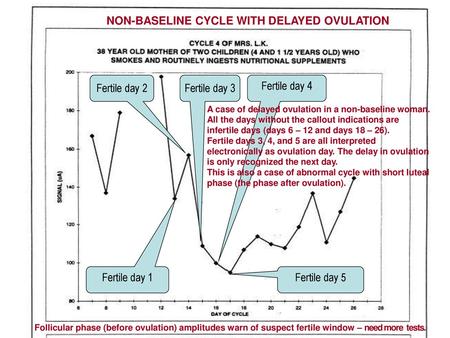 NON-BASELINE CYCLE WITH DELAYED OVULATION