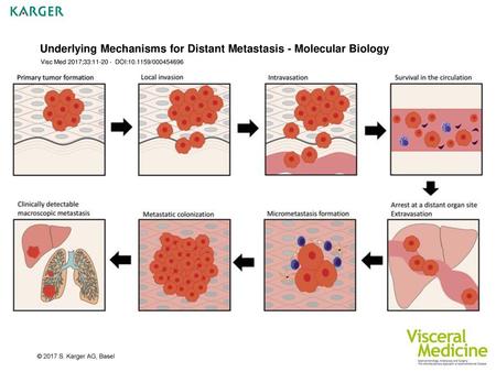 Underlying Mechanisms for Distant Metastasis - Molecular Biology