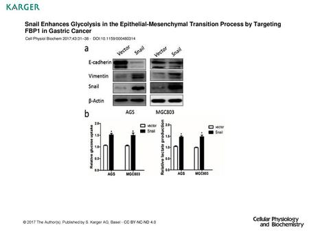 Snail Enhances Glycolysis in the Epithelial-Mesenchymal Transition Process by Targeting FBP1 in Gastric Cancer Cell Physiol Biochem 2017;43:31–38 - DOI:10.1159/000480314.