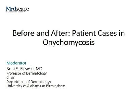 Before and After: Patient Cases in Onychomycosis