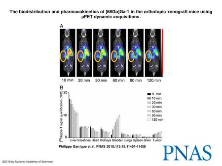 The biodistribution and pharmacokinetics of [68Ga]Ga-1 in the orthotopic xenograft mice using µPET dynamic acquisitions. The biodistribution and pharmacokinetics.