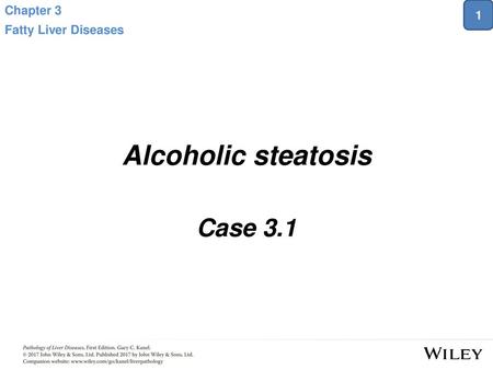 Chapter 3 Fatty Liver Diseases 1 Alcoholic steatosis Case 3.1.