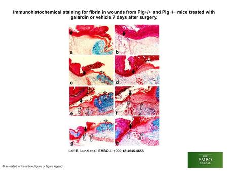 Immunohistochemical staining for fibrin in wounds from Plg+/+ and Plg−/− mice treated with galardin or vehicle 7 days after surgery. Immunohistochemical.