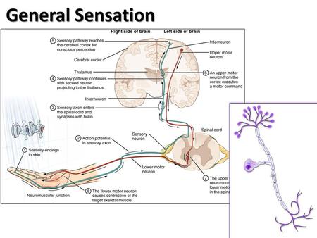 General Sensation.