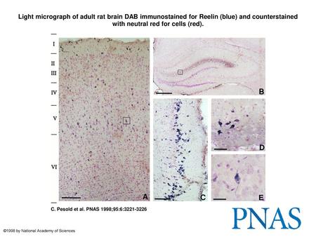 Light micrograph of adult rat brain DAB immunostained for Reelin (blue) and counterstained with neutral red for cells (red). Light micrograph of adult.