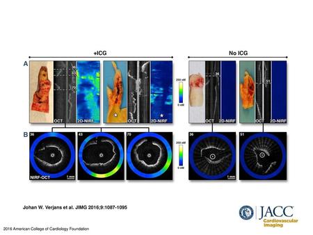 Johan W. Verjans et al. JIMG 2016;9: