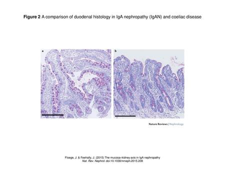 Nat. Rev. Nephrol. doi: /nrneph