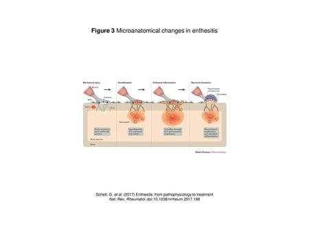 Figure 3 Microanatomical changes in enthesitis