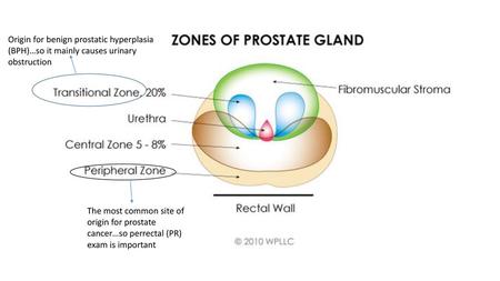 Origin for benign prostatic hyperplasia