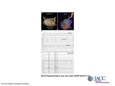 David Filgueiras-Rama, and José Jalife JACEP 2016;2:1-13