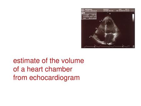 Estimate of the volume of a heart chamber from echocardiogram.