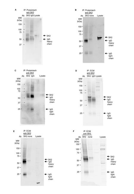 A IP: Proteintech anti-SK2 B IP: Proteintech anti-SK2 Ab SK2 IgG