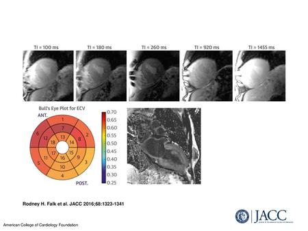 Rodney H. Falk et al. JACC 2016;68: