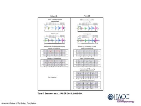 Tom F. Brouwer et al. JACEP 2016;2: