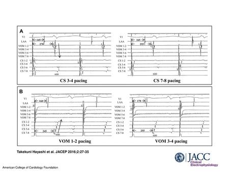 Takekuni Hayashi et al. JACEP 2016;2:27-35